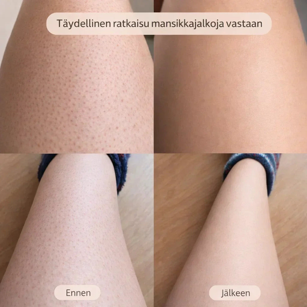SilvaTrim – 2-in-1 karvanpoistaja sileään ihoon