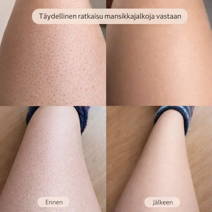 SilvaTrim – 2-in-1 karvanpoistaja sileään ihoon